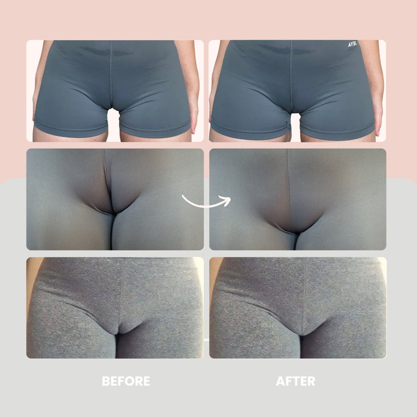 REFLEY™ Onzichtbare Camel Toe String